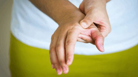 Naturally treating arthritis joint pain at Midland Sports Rehab and Freeland Sports Rehab